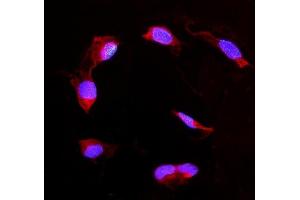 IF analysis of DDAH2 using anti-DDAH2 antibody (ABIN4886561). (DDAH2 Antikörper  (C-Term))