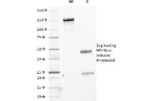 SDS-PAGE Analysis Purified Cytokeratin, HMW MAb (KRTH/1076). (Cytokeratin 2 Antikörper)