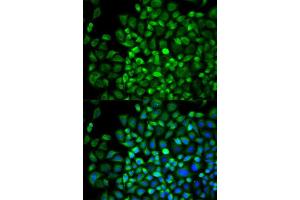 Immunofluorescence analysis of A549 cell using ANGPTL4 antibody. (ANGPTL4 Antikörper  (AA 26-406))
