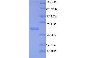 SDS-PAGE (SDS) image for Tryptase alpha/beta 1 (TPSAB1) (AA 35-267), (partial) protein (His tag) (ABIN5710538) (TPSAB1 Protein (AA 35-267, partial) (His tag))