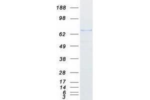 Western Blotting (WB) image for Ring Finger Protein 220 (RNF220) protein (Myc-DYKDDDDK Tag) (ABIN2731044)