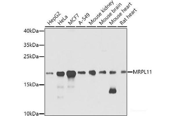 MRPL11 anticorps