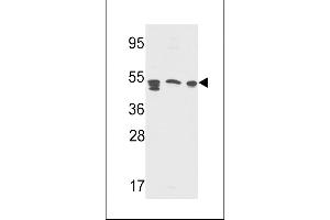 Western blot analysis in Y79,A2058,CEM cell line lysates(35ug/lane) (APCS Antikörper  (AA 285-314))