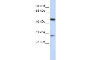 WB Suggested Anti-C13orf31 Antibody Titration: 0. (LACC1 Antikörper  (Middle Region))