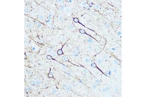 Immunohistochemistry of paraffin-embedded rat brain using Neurofilament M Rabbit pAb (ABIN7268865) at dilution of 1:100 (40x lens). (NEFM Antikörper  (AA 200-300))