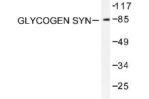 Image no. 1 for anti-Glycogen Synthase (GYS) antibody (ABIN265444) (Glycogen Synthase Antikörper)