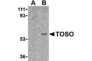 Western blot analysis of Toso in human lung tissue lysate with this product at 1 μg/ml in either the (A) presence, or (B) absence of blocking peptide.