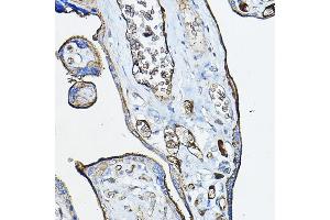 Immunohistochemistry of paraffin-embedded human placenta using CHRN Rabbit pAb (ABIN6133256, ABIN6138583, ABIN6138584 and ABIN6218660) at dilution of 1:100 (40x lens). (CHRNA7 Antikörper  (AA 23-230))