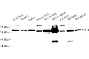 Western blot analysis of MST1 (ABIN7075561) at dilution of 1: 1000 (STK4 Antikörper)