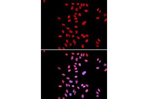 Immunofluorescence analysis of U2OS cells using DKC1 antibody (ABIN5970956). (DKC1 Antikörper)