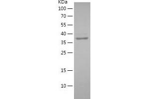 Western Blotting (WB) image for Myosin, Heavy Polypeptide 10, Non-Muscle (MYH10) (AA 1150-1450) protein (His tag) (ABIN7124070)
