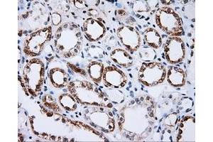 Immunohistochemical staining of paraffin-embedded Kidney tissue using anti-BTK mouse monoclonal antibody. (BTK Antikörper)