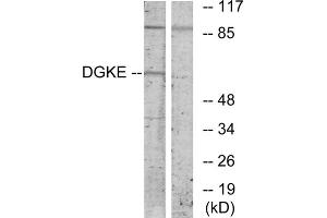 Western blot analysis of extracts from K562 cells, using DGKE antibody. (DGKE Antikörper  (Internal Region))