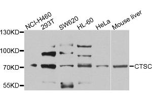 Western blot analysis of extracts of various cell lines, using CTSC antibody (ABIN5974676) at 1/1000 dilution. (CTSC Antikörper)