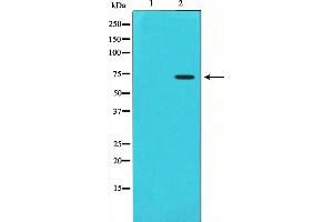 Western blot analysis on HuvEc cell lysate using Cox1 Antibody,The lane on the left is treated with the antigen-specific peptide. (PTGS1 Antikörper  (C-Term))