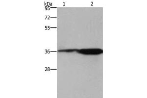 Western Blot analysis of 293T cell and Mouse brain tissue using CD89 Polyclonal Antibody at dilution of 1:550 (FCAR Antikörper)