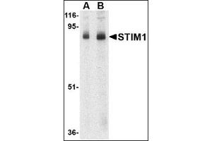 Western blot analysis of STIM1 in mouse thymus tissue lysate with this product at (A) 1 and (B) 2 μg/ml. (STIM1 Antikörper  (C-Term))