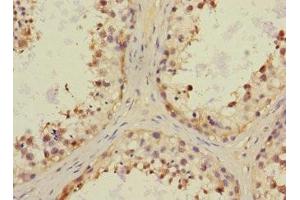 Immunohistochemistry of paraffin-embedded human testis tissue using ABIN7161348 at dilution of 1:100 (CHRNA6 Antikörper  (AA 26-239))