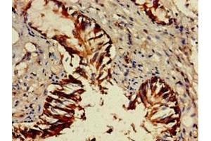 Immunohistochemistry of paraffin-embedded human lung tissue using ABIN7154424 at dilution of 1:100