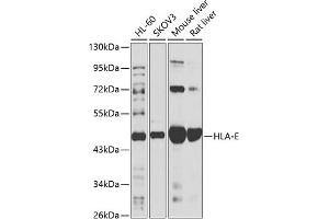 Western blot analysis of extracts of various cell lines, using HLA-E antibody (ABIN6128020, ABIN6141842, ABIN6141844 and ABIN6218491) at 1:1000 dilution.