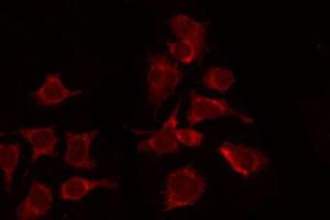 ABIN6267328 staining 293 by IF/ICC. (CSF1R Antikörper  (pTyr809))