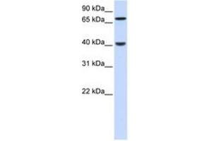 Image no. 1 for anti-PDZ and LIM Domain 3 (PDLIM3) (N-Term) antibody (ABIN6741278) (PDLIM3 Antikörper  (N-Term))
