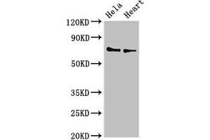 Western Blot Positive WB detected in: Hela whole cell lysate, Mouse heart tissue All lanes: PLS3 antibody at 3. (Plastin 3 Antikörper  (AA 310-455))