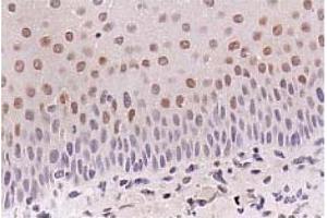 Immunohistochemistry (IHC) image for anti-Cyclin-Dependent Kinase Inhibitor 1A (p21, Cip1) (CDKN1A) antibody (ABIN487485) (p21 Antikörper)