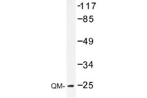 Image no. 1 for anti-Ribosomal Protein L10 (RPL10) antibody (ABIN317605) (RPL10 Antikörper)