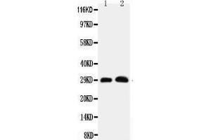 Anti-Aquaporin 5 antibody, Western blotting Lane 1: Rat Lung Tissue Lysate Lane 2: Rat Testis Tissue Lysate (Aquaporin 5 Antikörper  (C-Term))