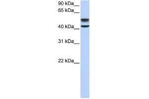 GNS antibody used at 1 ug/ml to detect target protein. (GNS Antikörper  (C-Term))