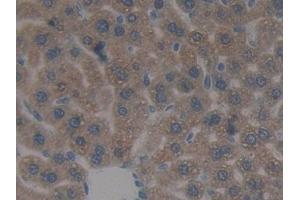 Immunohistochemistry (IHC) image for anti-Sulfotransferase Family, Cytosolic, 1A, Phenol-Preferring, Member 1 (SULT1A1) (AA 3-285) antibody (ABIN7433363)