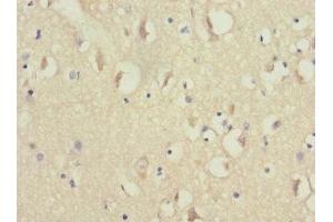 Immunohistochemistry of paraffin-embedded human brain tissue using ABIN7160945 at dilution of 1:100 (NDUFV1 Antikörper  (AA 1-250))