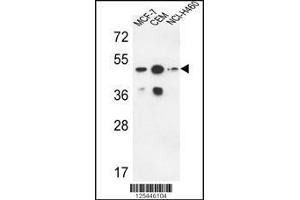 Western blot analysis in MCF-7,CEM,NCI-H460 cell line lysates (35ug/lane). (Sphingomyelin Synthase 2 Antikörper  (C-Term))
