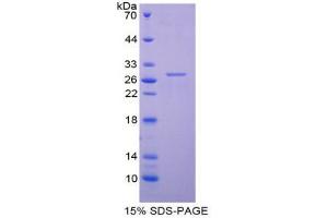 SDS-PAGE analysis of Human TNNI3 Protein. (TNNI3 Protein (His tag))