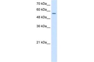 Western Blotting (WB) image for anti-Nuclear Receptor Subfamily 1, Group H, Member 2 (NR1H2) antibody (ABIN2462871)
