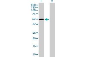 Western Blot analysis of MASP1 expression in transfected 293T cell line by MASP1 MaxPab polyclonal antibody. (MASP1 Antikörper  (AA 1-380))