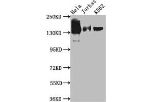 Western Blot Positive WB detected in: Hela whole cell lysate, Jurkat whole cell lysate, K562 whole cell lysate All lanes: SA2 antibody at 1:1000 Secondary Goat polyclonal to rabbit IgG at 1/50000 dilution Predicted band size: 142, 146 kDa Observed band size: 142 kDa (Rekombinanter STAG2 Antikörper)