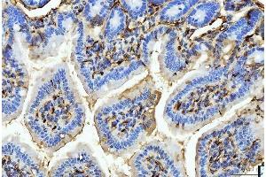 IHC analysis of FABP4 using anti-FABP4 antibody (ABIN7603145).