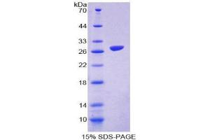 SDS-PAGE (SDS) image for Signal-Regulatory Protein beta 1 (SIRPB1) (AA 129-342) protein (His tag) (ABIN2126757)