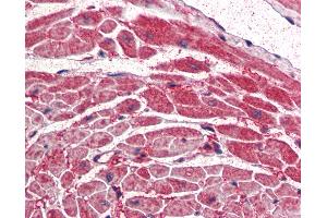 Anti-PIK3CA antibody IHC of human heart. (PIK3CA Antikörper  (AA 878-891))
