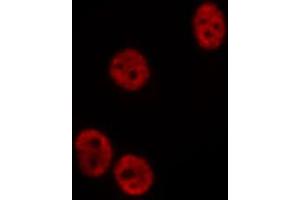 ABIN6275194 staining  COLO205 cells by IF/ICC. (Msx2/Hox8 Antikörper  (Internal Region))