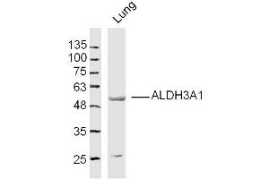 Mouse lung lysates probed with ALDH3A1 Polyclonal Antibody, Unconjugated  at 1:300 dilution and 4˚C overnight incubation. (ALDH3A1 Antikörper  (AA 151-250))