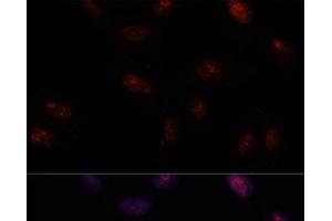 Immunofluorescence analysis of U-2 OS cells using SF3B1 Polyclonal Antibody at dilution of 1:100. (SF3B1 Antikörper)