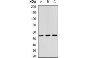Western blot analysis of RNF81 expression in A549 (A), SW620 (B), HT29 (C) whole cell lysates. (TRIM21 Antikörper)