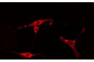 ABIN6274771 staining HeLa cells by IF/ICC. (RPL18 Antikörper)