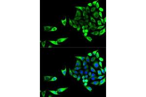 Immunofluorescence analysis of U2OS cells using GOT1 antibody (ABIN6131239, ABIN6141283, ABIN6141284 and ABIN6221514). (GOT1 Antikörper  (AA 244-413))