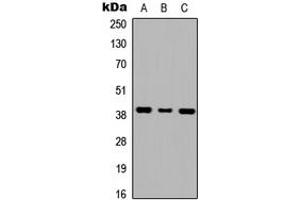 Western blot analysis of GALR1 expression in HEK293T (A), NS-1 (B), H9C2 (C) whole cell lysates. (Galanin Receptor 1 Antikörper  (Center))