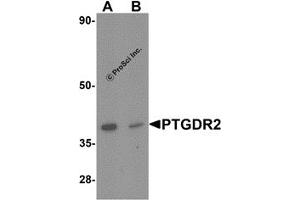 Western Blotting (WB) image for anti-Prostaglandin D2 Receptor 2 (PTGDR2) antibody (ABIN1077429) (Prostaglandin D2 Receptor 2 (PTGDR2) Antikörper)