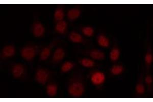 ABIN6266978 staining HuvEc by IF/ICC. (SIX Homeobox 6 Antikörper  (Internal Region))